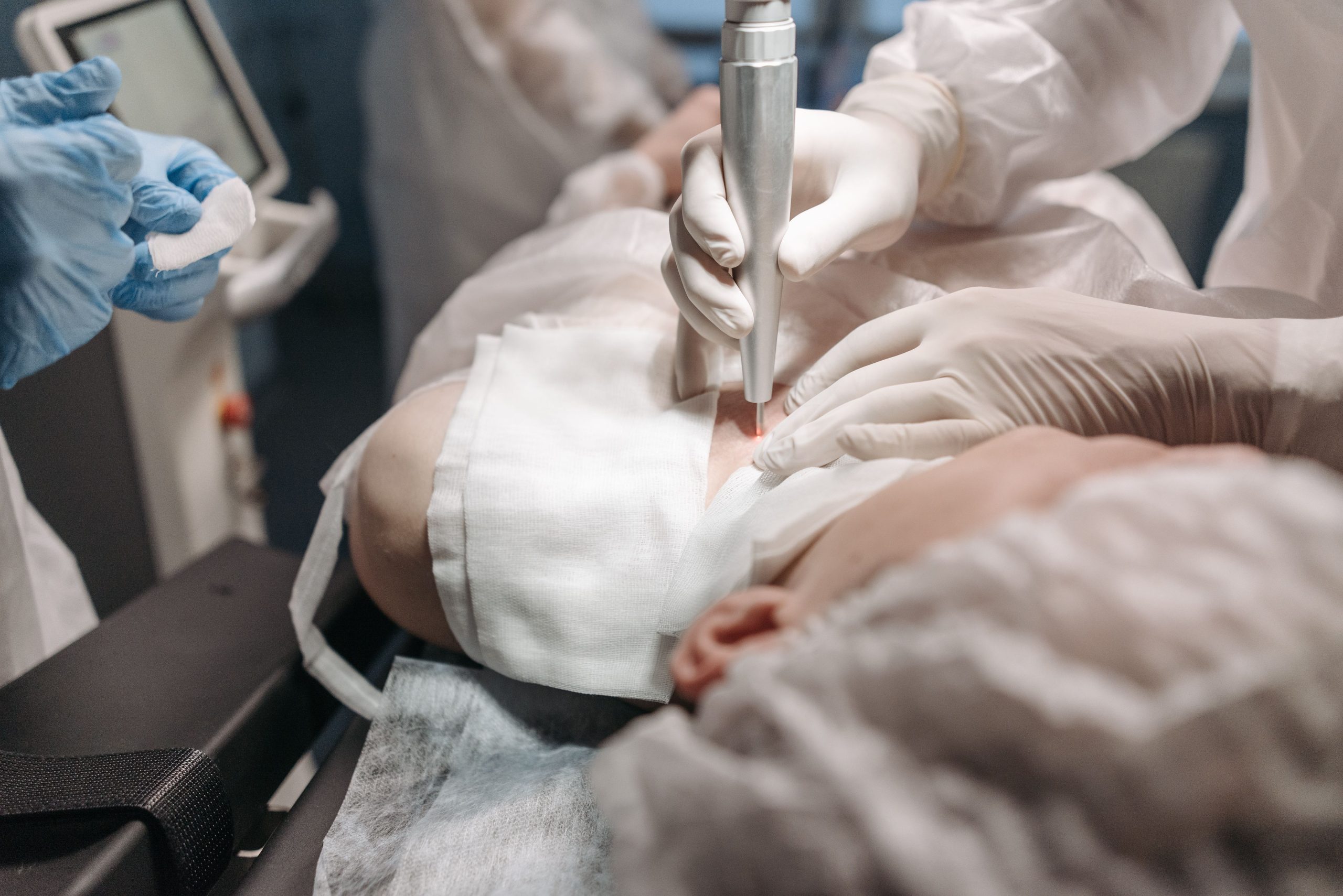 Professionnels effectuant traitement laser vasculaire